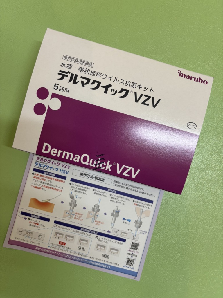 水痘・帯状疱疹、口唇ヘルペスの抗原検査による診断キットを導入しました